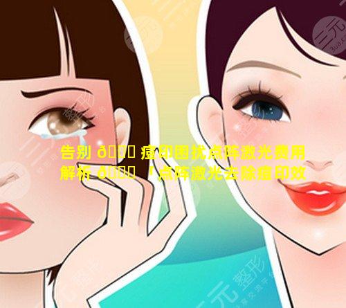 告别 🐘 痘印困扰点阵激光费用解析 🍀 「点阵激光去除痘印效果如何」